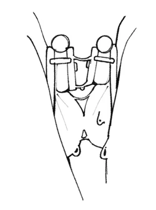 When femboys kissing Thumbnail